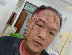 Villa Sriwijaya Siantar Berdarah, Kepala Bocor Akibat Tak Terima Ditegur sudah Larut Malam